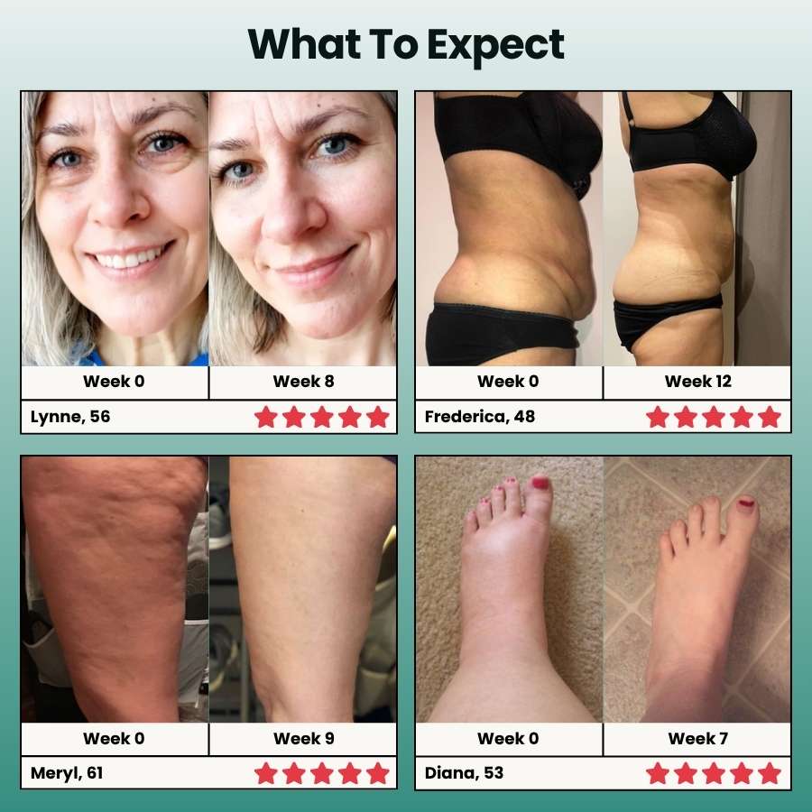 21-in-1 Lymphatic Drainage Softgels for Menopausal Women